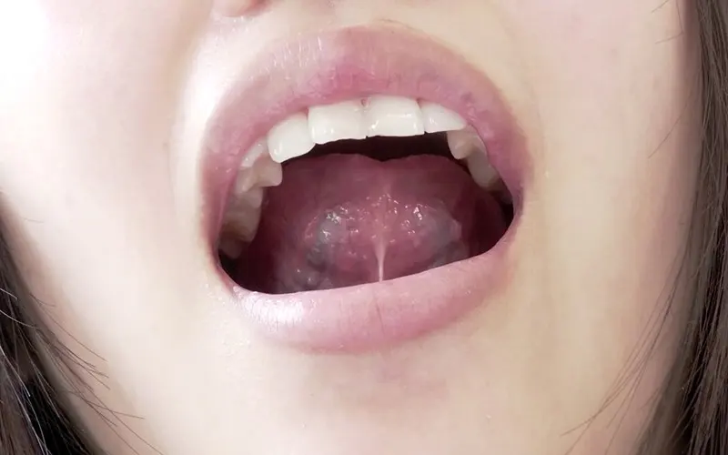 歯フェチ ～歯・舌ベロ観察～